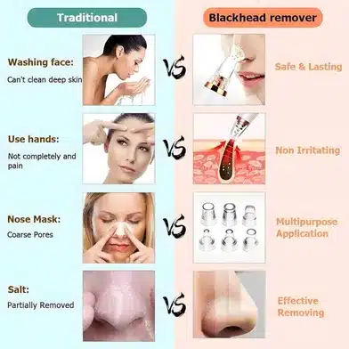 Blackhead Remover Machine – Electric Pore Cleaner Vacuum