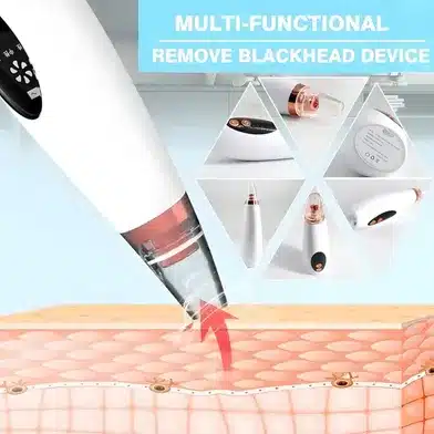 Blackhead Remover Machine – Electric Pore Cleaner Vacuum